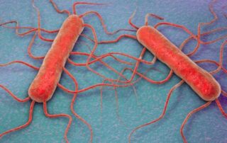 listeria-formaggio-batteriocine