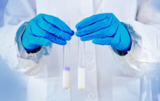 latte - analisi - laboratorio