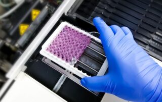 metodo-analisi-elisa