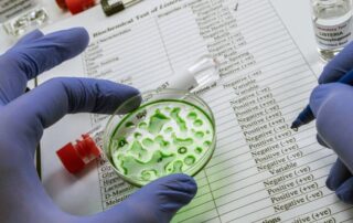 listeria-piastrina