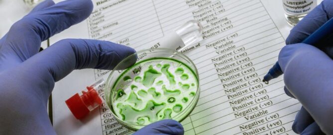 listeria-piastrina
