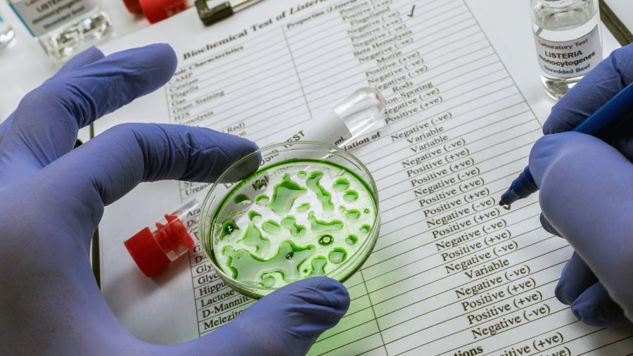 listeria-piastrina listeria-piastrina